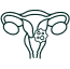 Cáncer de cuello uterino
