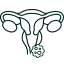 Cáncer de vagina2