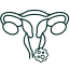 Cáncer de vagina